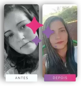 imgi_63_LindaCaps-Pagina-Antes_Depois-3-280x300